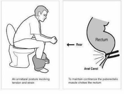 youve-been-sitting-on-the-toilet-wrong-your-whole-life-this-is-how-to-do-it-right-1