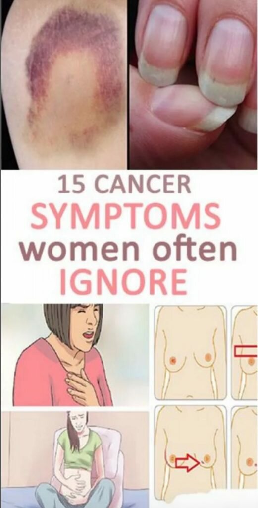 15 Cancer Symptoms Women Often Ignore!!!