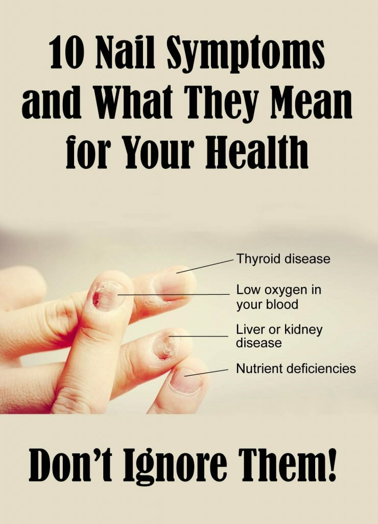 Kidney Failure vitamins