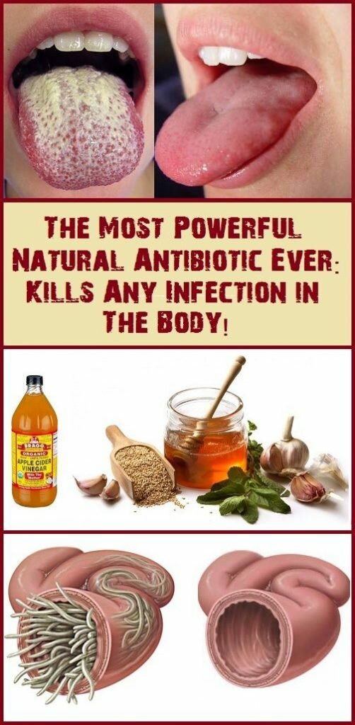 This Is The Most Powerful Natural Antibiotic Ever – Kills Any Infections In The Body