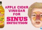 Apple-Cider-Vinegar-for-Sinus-Infection